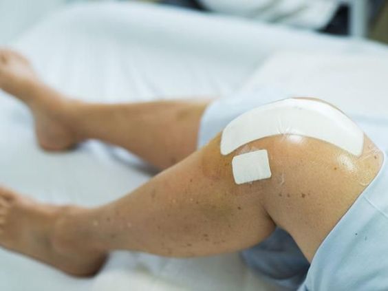 Knee Replacement Surgery